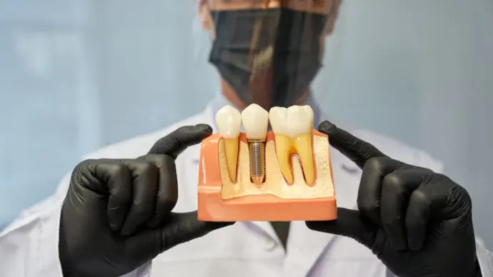 Dental implants model shown by dentist in Paradise Valley, AZ